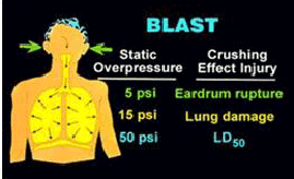 How blast injuries cause trauma 