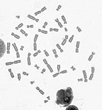 closeup of slide showing normal metaphase spread of 46 chromosomes