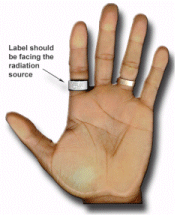 Finger ring dosimeter